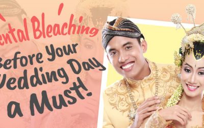 Bleaching Gigi Sebelum Pernikahan