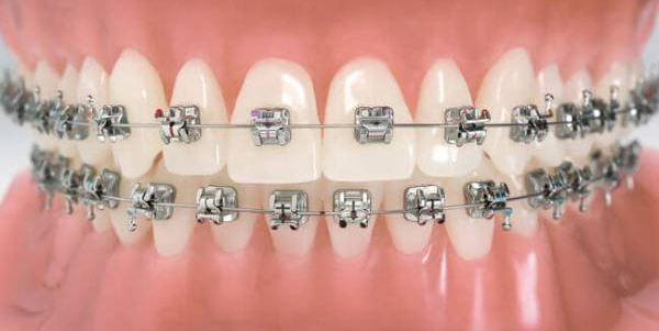 Klinik Perawatan Gigi Dentistime