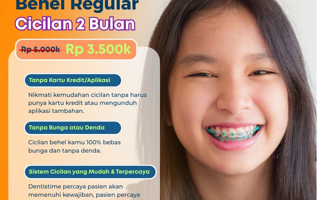 Pemasangan Kawat Gigi di Klinik Perawatan Dentistime