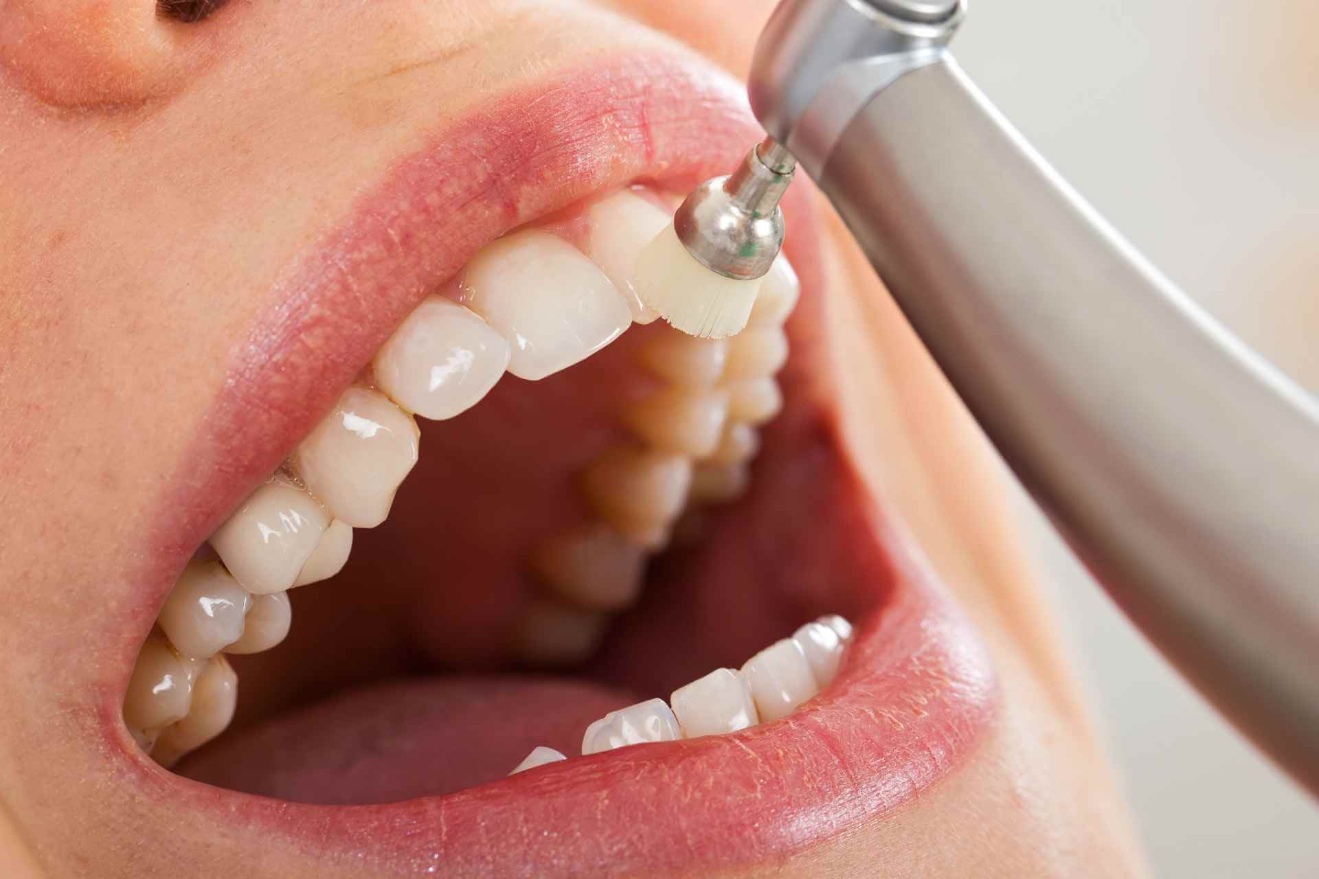 Perawatan relaksasi dan pembersihan mendalam dental spa di Dentistime Pekayon dan Cikunir