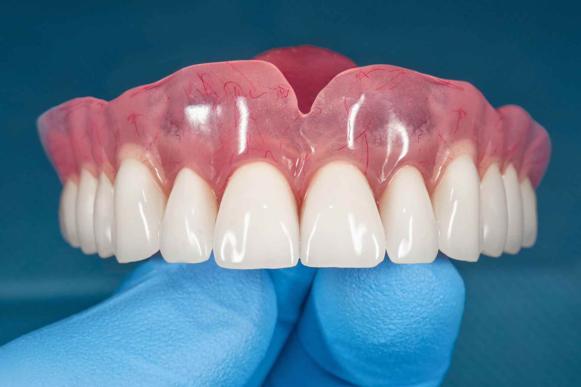 Pembuatan gigi tiruan penuh yang nyaman dan natural di klinik gigi Dentistime