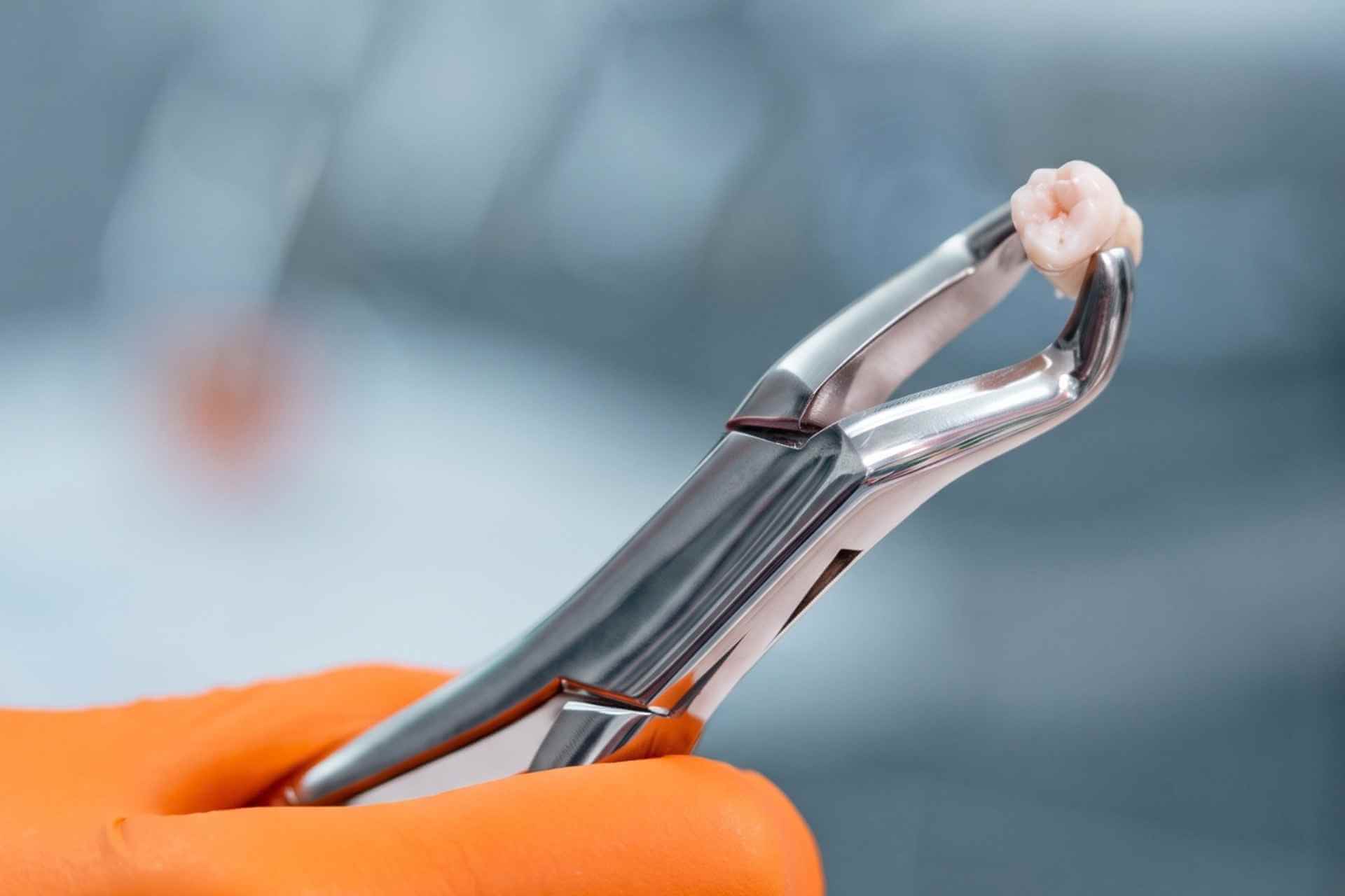 Tindakan pencabutan gigi di klinik gigi Dentistime